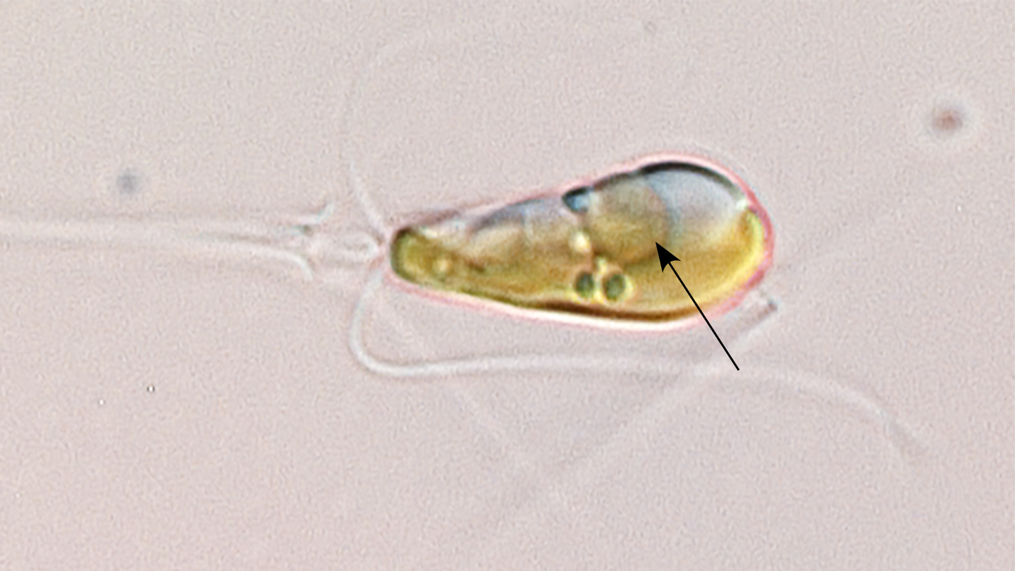 nitrogen-fixing organelle in algae